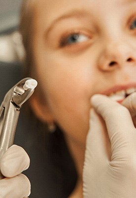 Child with an extracted tooth